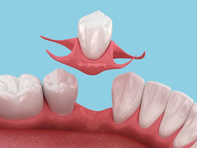 Dentures at Bambi Dental Clinics